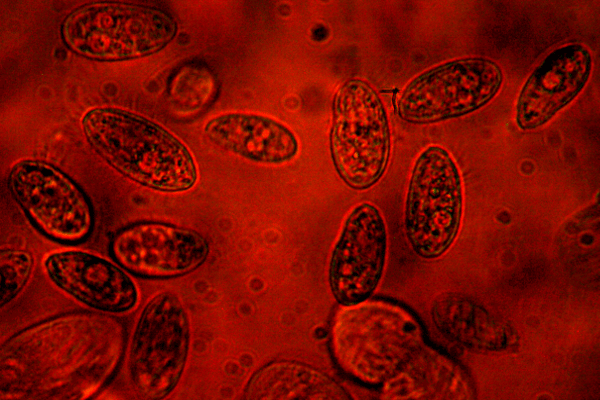 Aquakulturkonzepte beinhalten Gesundheitsmanagement, Futterkonzeption, Besatzdichten, Fischernte, Filterpflege plus Personalmanagement.